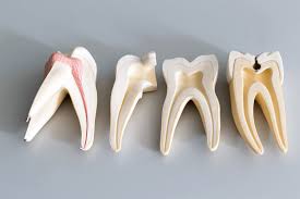 different-parts-teeth-root-canal-information-midtown-dentist-02