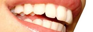 general-endodontic-treatments-01