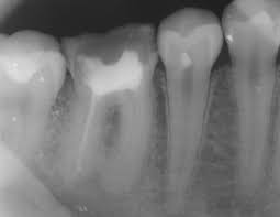 top-best-endodontics-endodontist-nyc-2019-2020-01