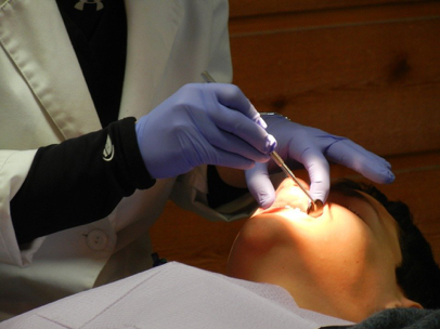 Preventing A Root Canal | Top Endodontist