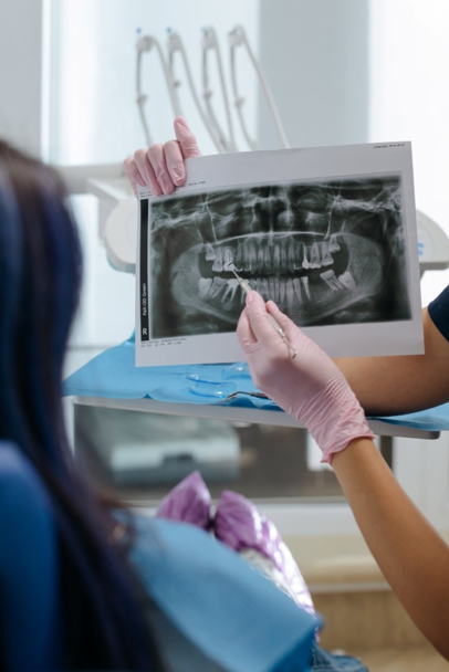 Are Bad Teeth Hereditary? Endodontics