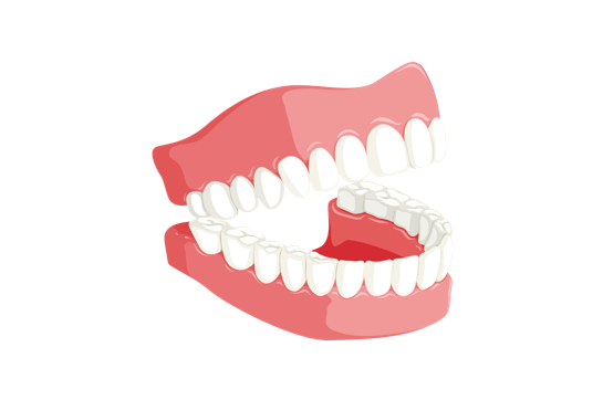 Healthy Tooth to Root Canal