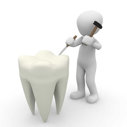 Most Common Teeth to Need Root Canal | Best Endodontist NYC