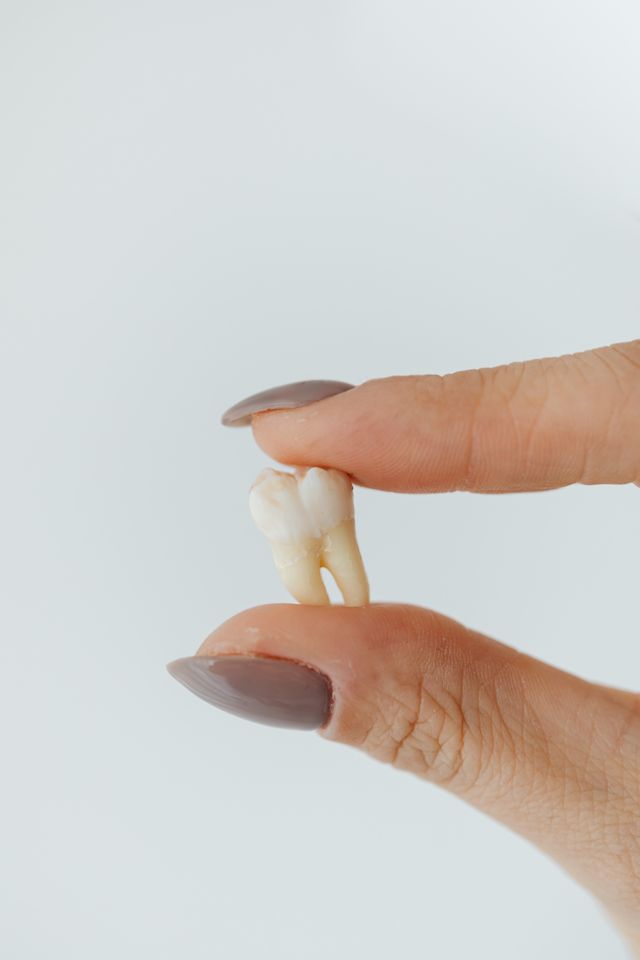 How Much Does a Root Canal Cost in NYC Without Insurance